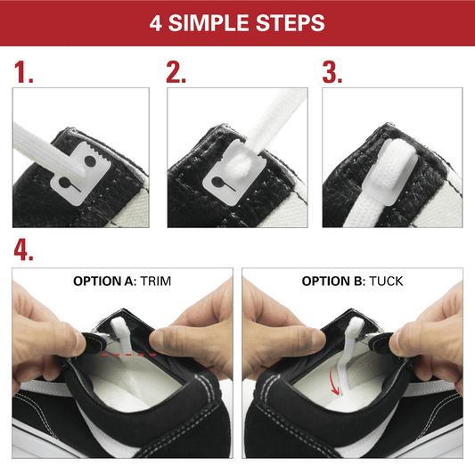 Lace Anchors® 2.0